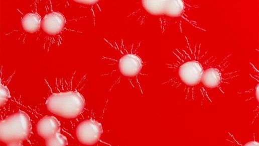 Przegląd Mleczarski 7/2026 – Listeria monocytogenes w zakładach mleczarskich – źródła i metody kontroli